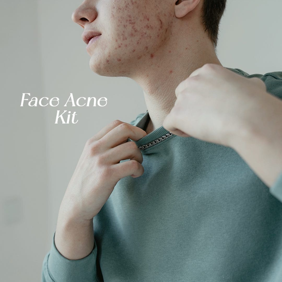 Skin Perfection Face Acne Kit