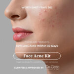 Face Acne Kit – Worth 407$