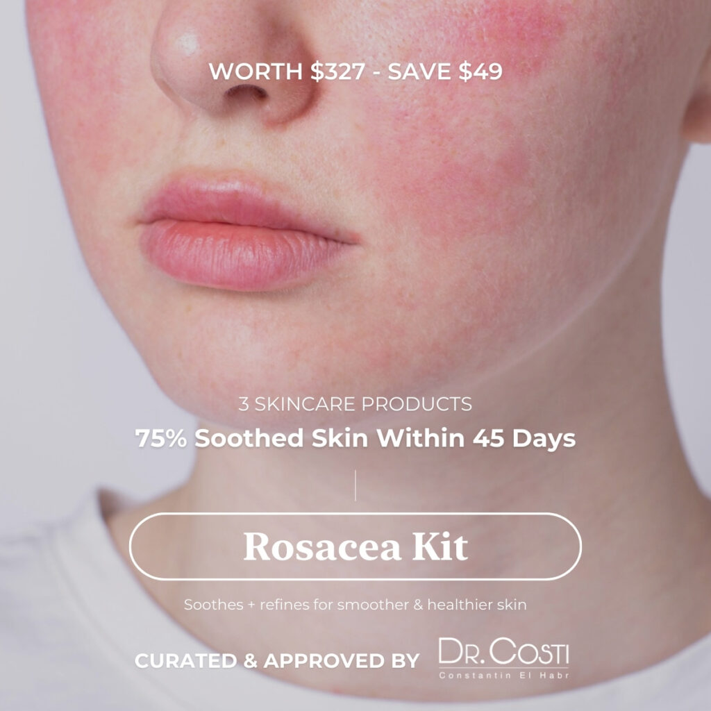 Rosacea Kit – Worth 327$