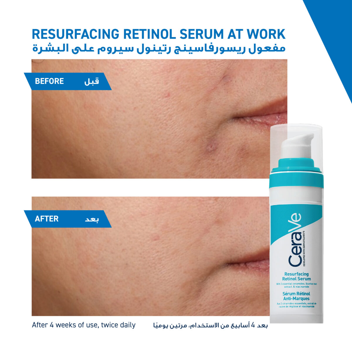 3337875829007_09 Cerave Resurfacing Retinol Serum – 30ml