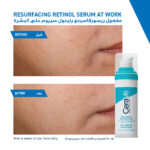 Cerave Resurfacing Retinol Serum – 30ml